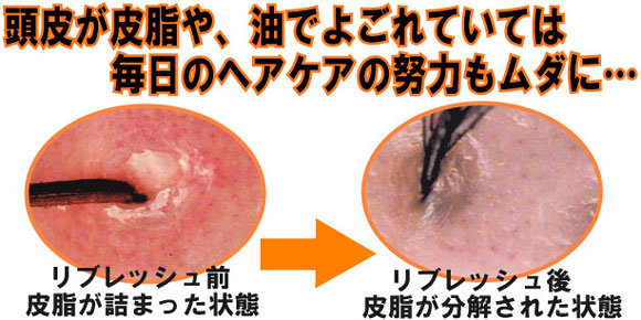 �����򃊃u���b�V���Ŕ玉����